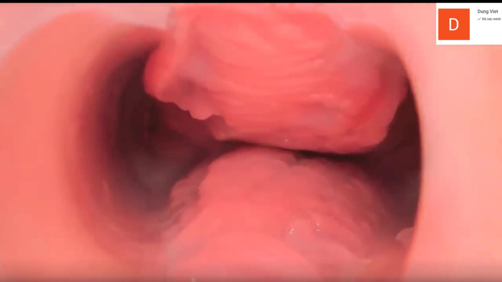 某美容美体医院内部流出高清内窥镜下女性阴道内部运动变化太粉嫩了怪不得肉棒都喜欢往里进