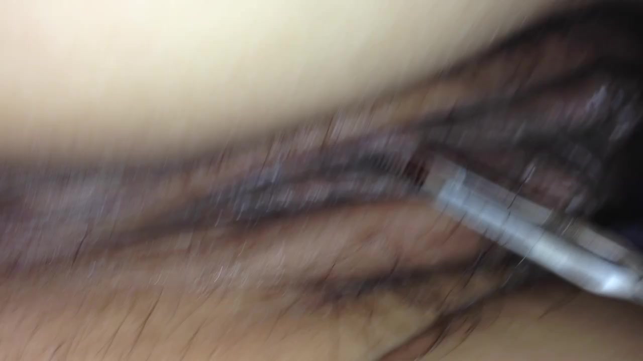 看看女人尿道有多深！